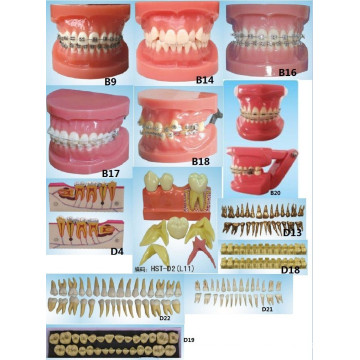 Equipo de Educación Científica Oral Modelo Ortodóntico Modelo Dental